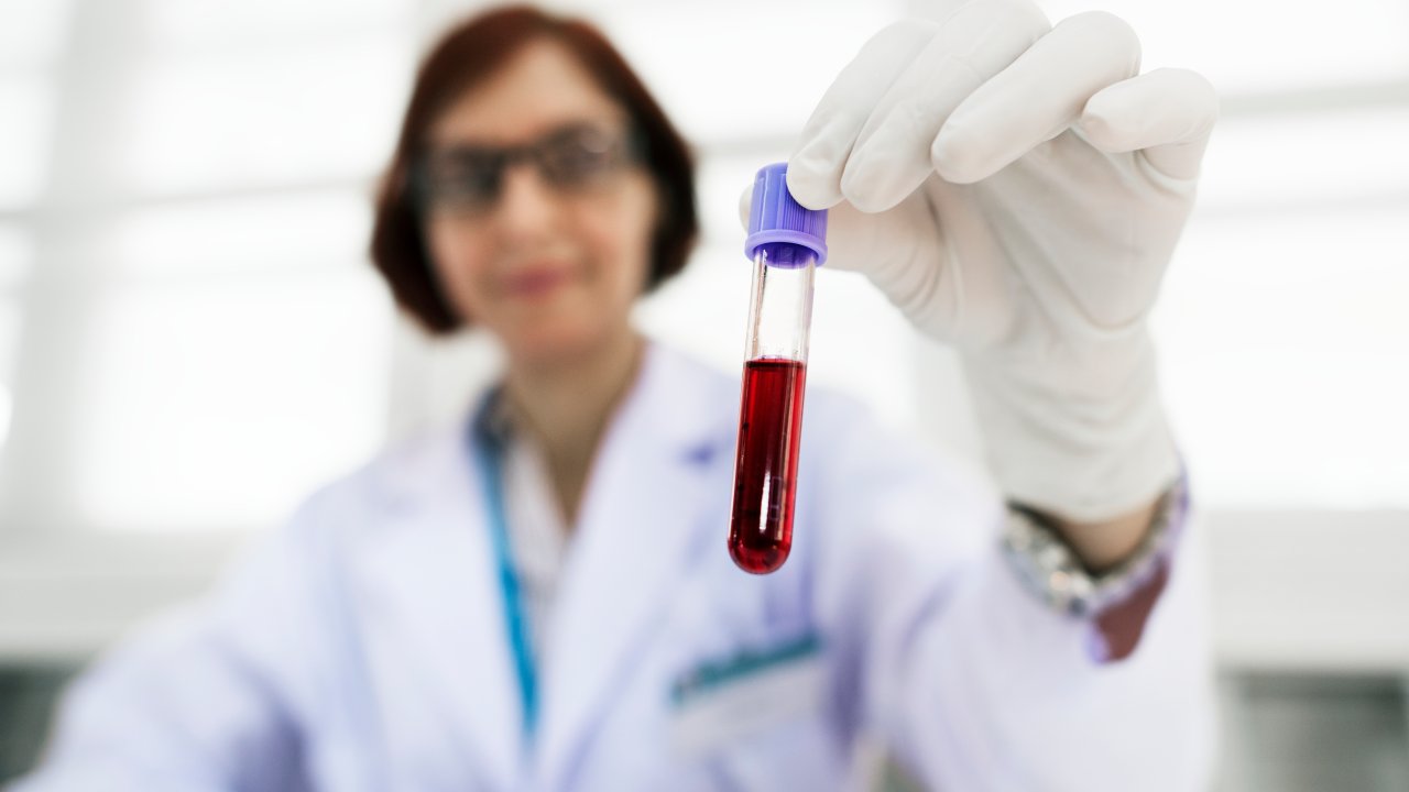 exame-ca-125-cancer-tumor-ginecologico