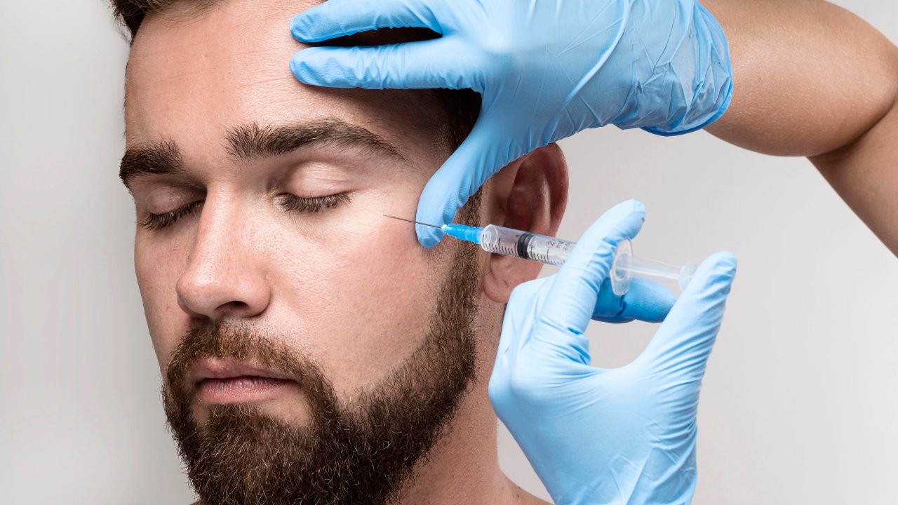 botox-masculino