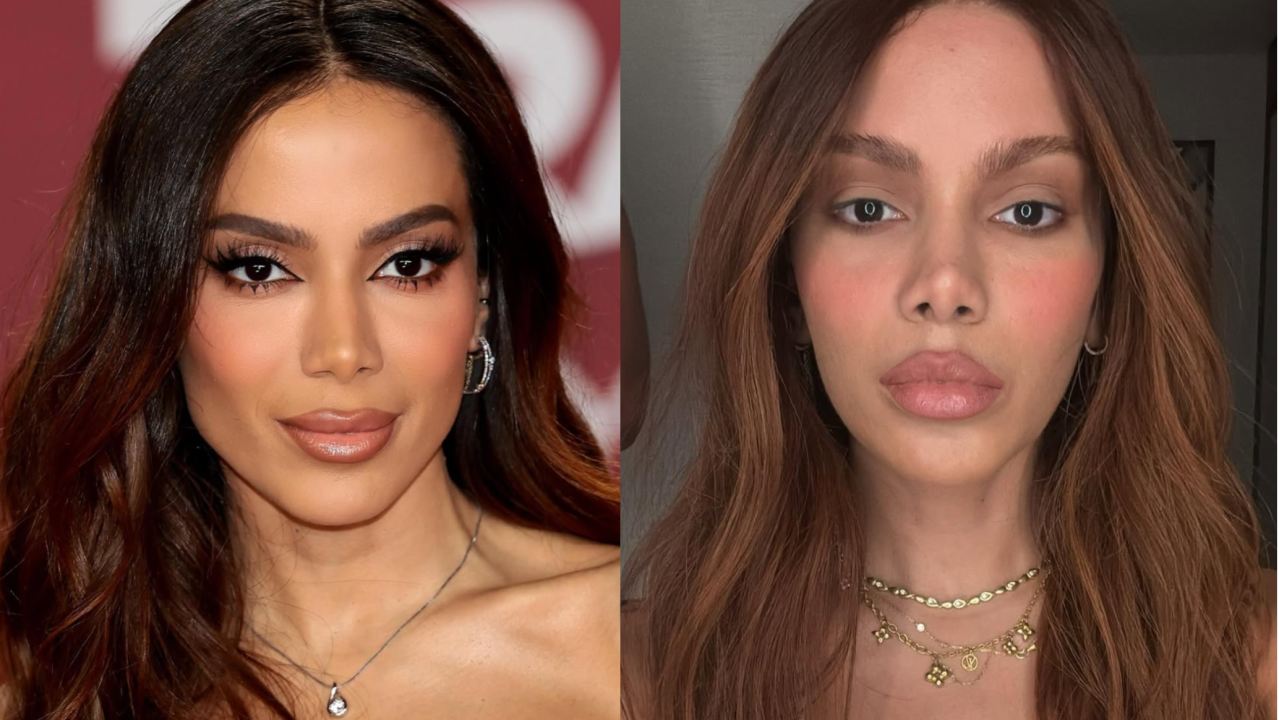 Anitta-lifting-novo-rosto