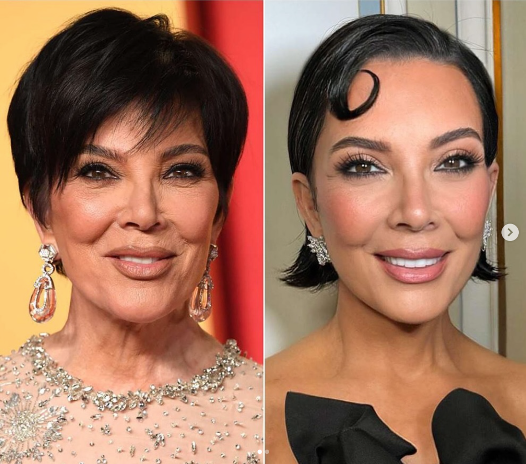 kris-jenner-lifting-facial