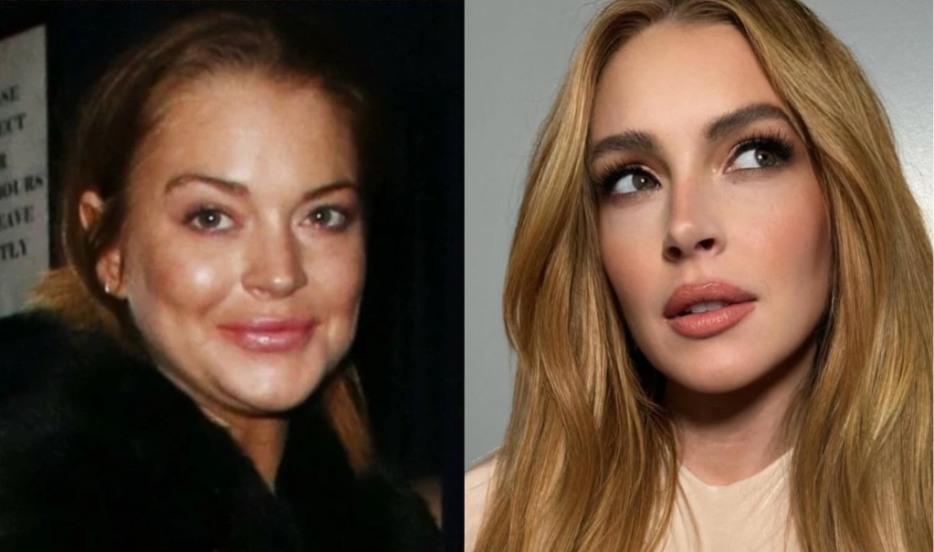 lindsay-lohan-antes-depois