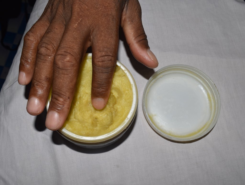 Manteiga de karité: saiba para que serve e como utilizá-la