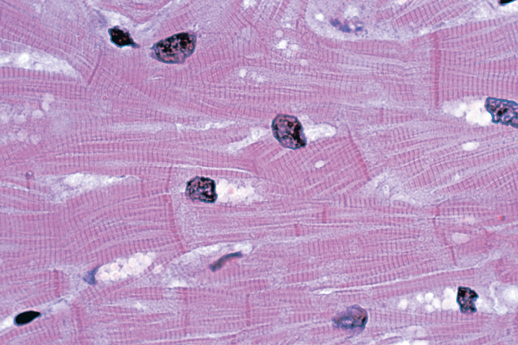 Zoom: um zíper no meio do peito