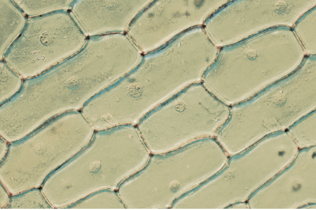 Zoom: lágrimas vão rolar