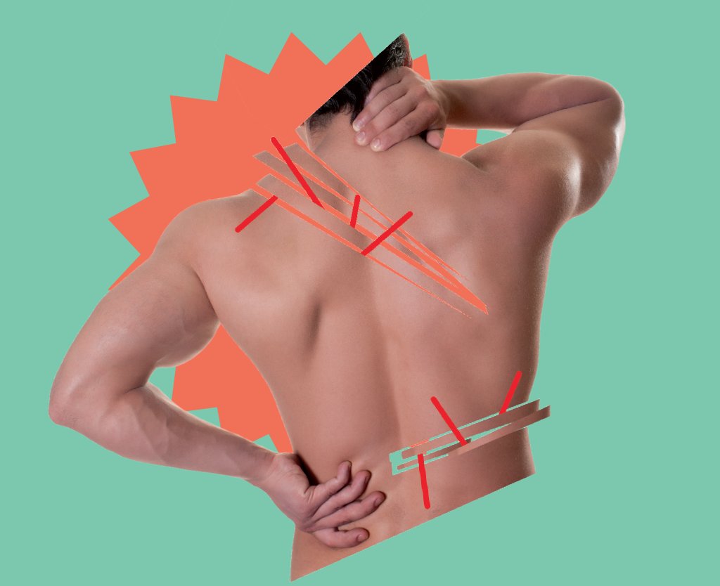 artrose-coluna artrose-coluna