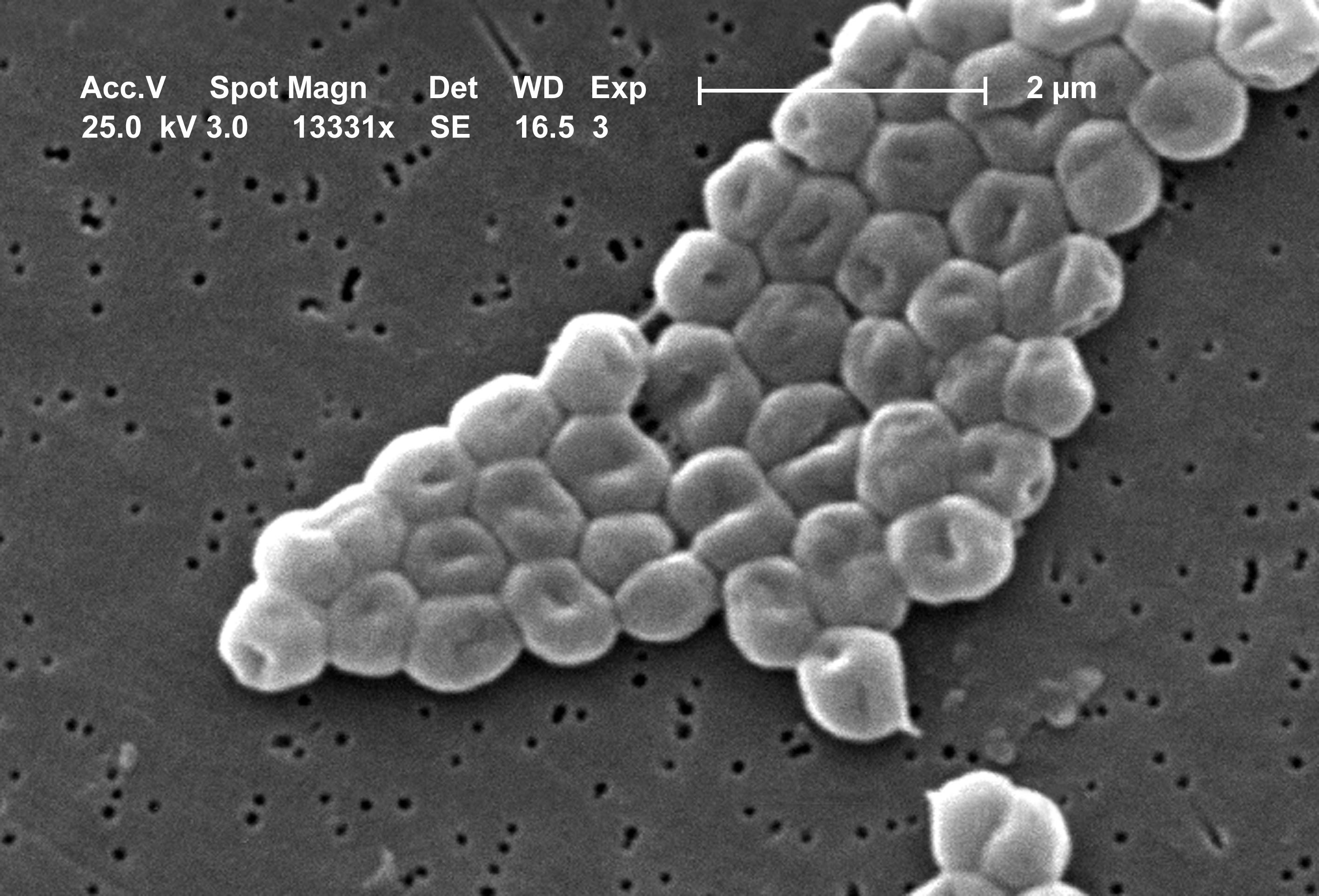 Imagem microscópica da bactéria Acinetobacter baumannii.