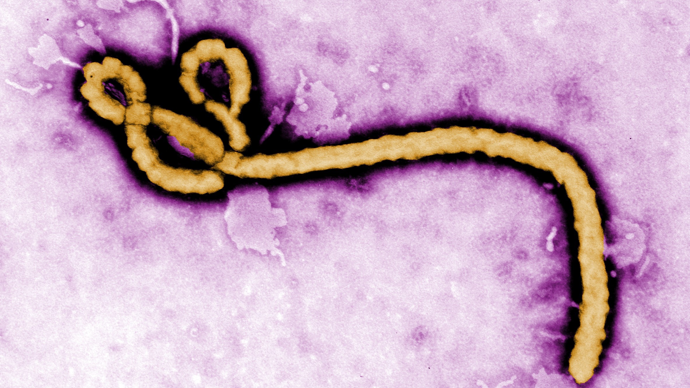 Raio-x do ebola ganha destaque após novo desdobramento em raio-x do ebola: cepa