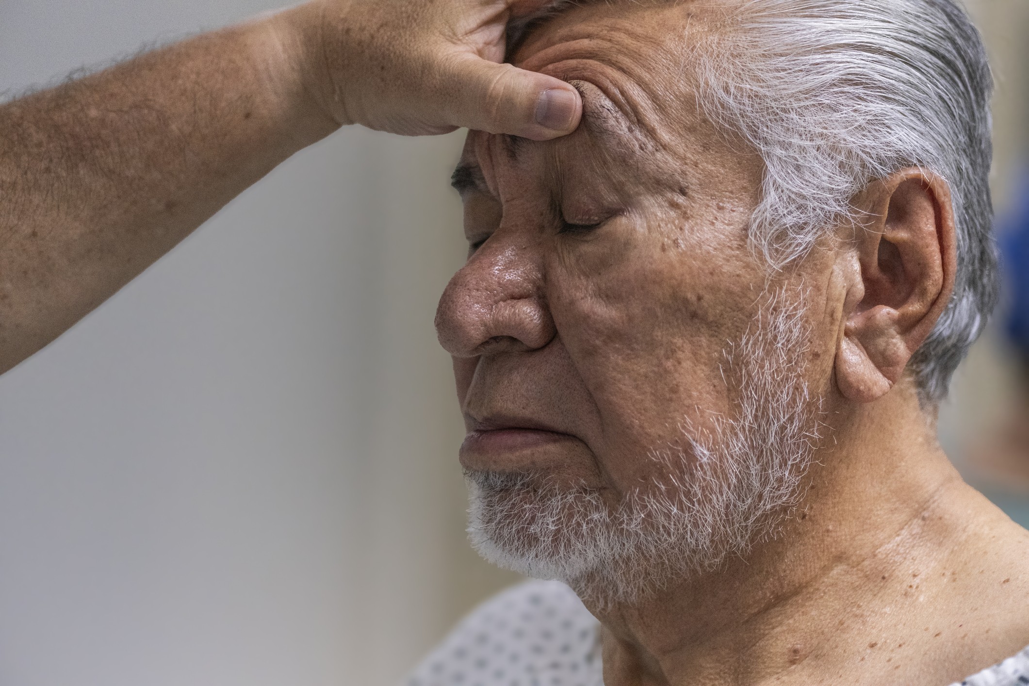 Blefaroplastia além da estética: quando a cirurgia das pálpebras melhora a visão
