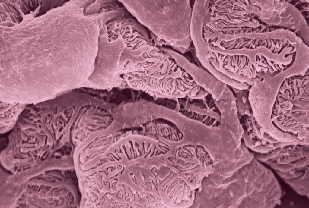 Microscopia eletrônica de varredura mostrando glomérulos renais em tons de rosa e roxo, com estruturas tubulares e capilares emaranhados